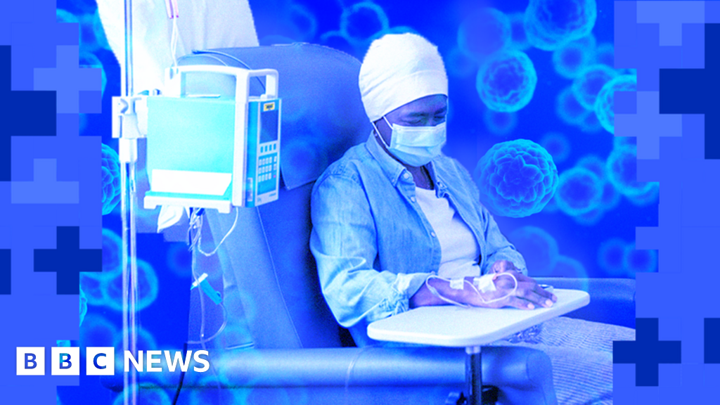 Most NHS Hospitals Fall Short of Cancer Targets – Mirror Brief